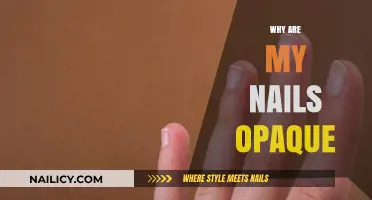 Why Are My Nails Opaque? Causes and Solutions Explained