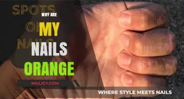 Why Are My Nails Orange? Causes, Concerns, and Solutions Explained