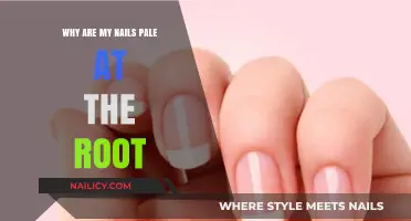 Pale Nail Roots: Causes and Concerns Explained Simply