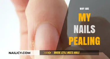 Why Are My Nails Peeling? Causes and Solutions for Brittle Nails