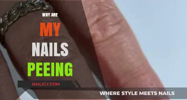 Why Are My Nails Peeling? Causes, Prevention, and Solutions Explained