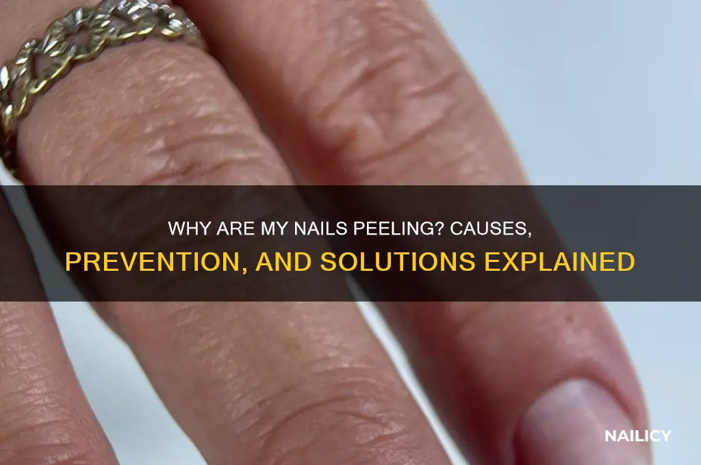 why are my nails peeing
