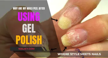Gel Polish: Why Do Nails Peel?