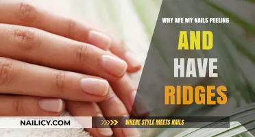 Peeling Nails with Ridges? Causes, Solutions, and Healthy Nail Care Tips