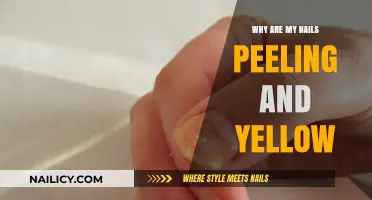 Peeling and Yellow Nails: Causes, Solutions, and Prevention Tips