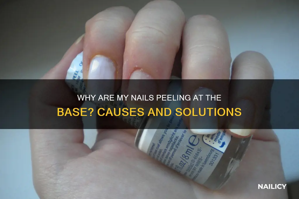 why are my nails peeling at the base