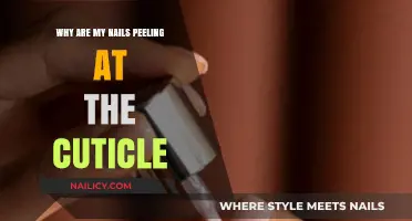 Why Are My Nails Peeling at the Cuticle? Causes and Solutions
