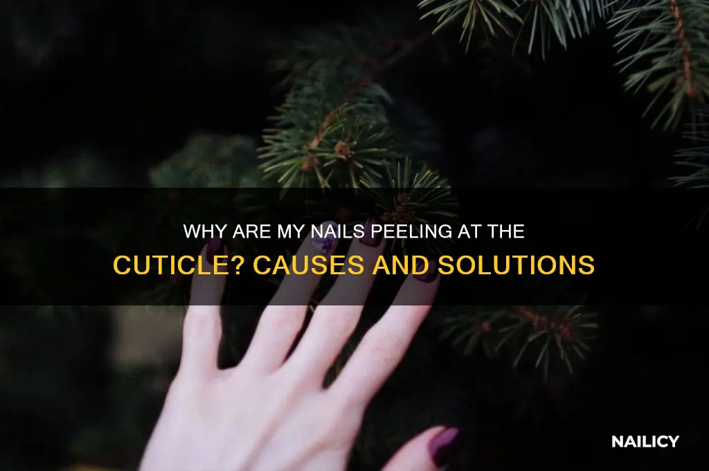 why are my nails peeling at the cuticle