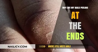 Why Are My Nails Peeling? Causes and Solutions for Brittle Tips