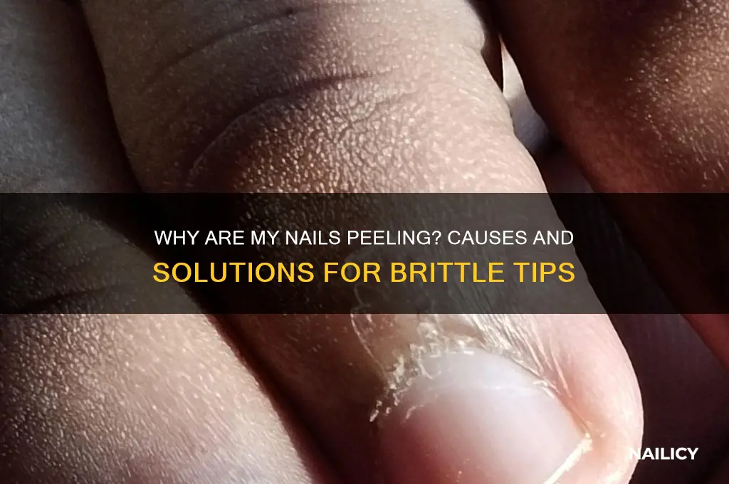 why are my nails peeling at the ends