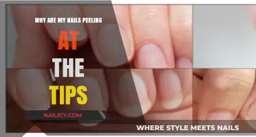 Why Are My Nails Peeling at the Tips? Causes and Solutions