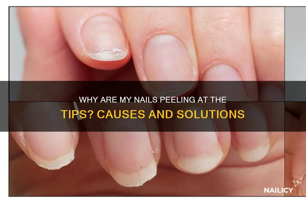 why are my nails peeling at the tips