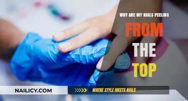 Why Are My Nails Peeling? Causes and Solutions for Brittle Tops