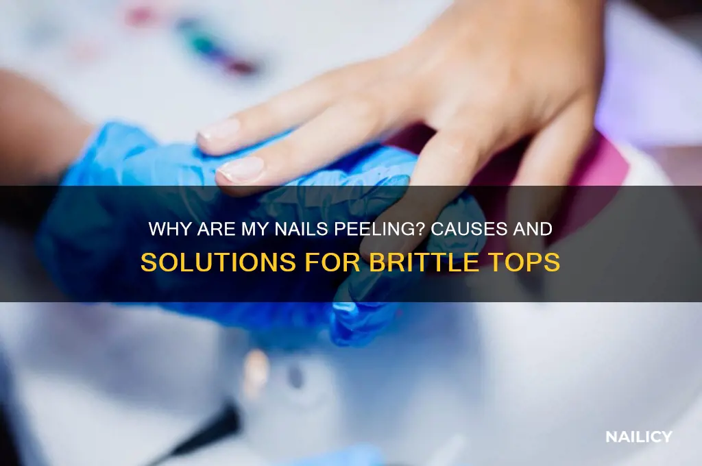 why are my nails peeling from the top