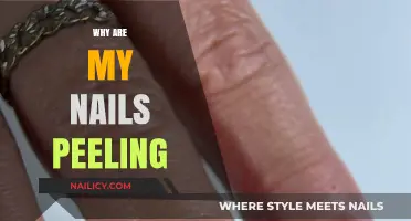 Why Are My Nails Peeling? Causes and Solutions for Brittle Nails