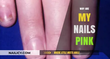 Why Are My Nails Pink? Understanding the Causes and Concerns