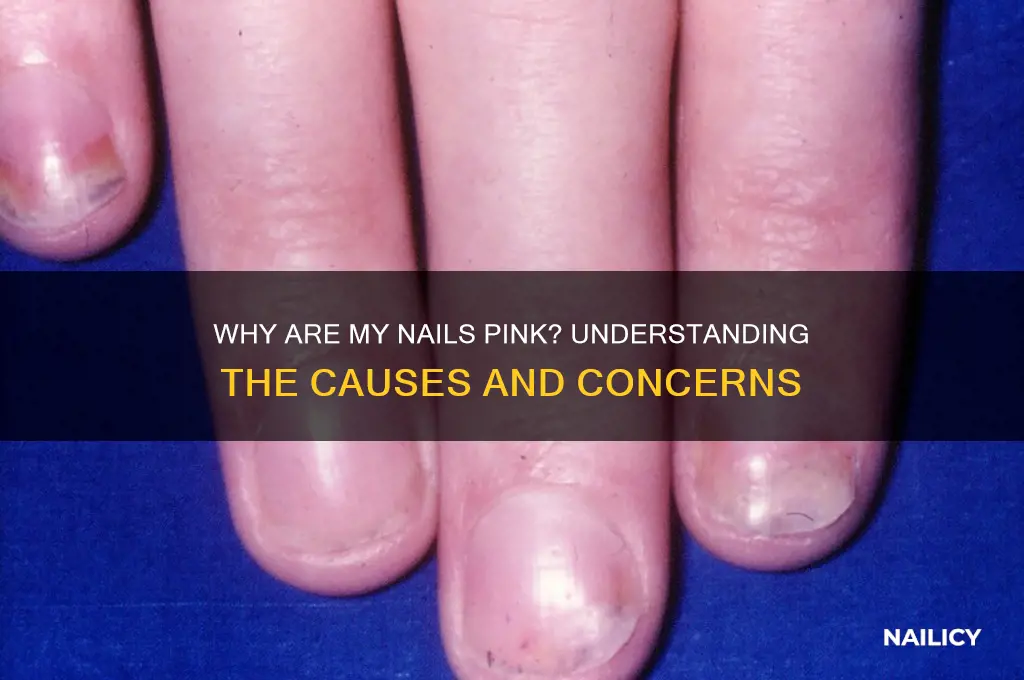 why are my nails pink