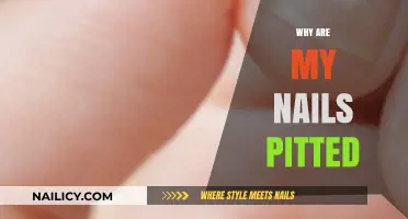 Why Are My Nails Pitted? Causes and Solutions Explained