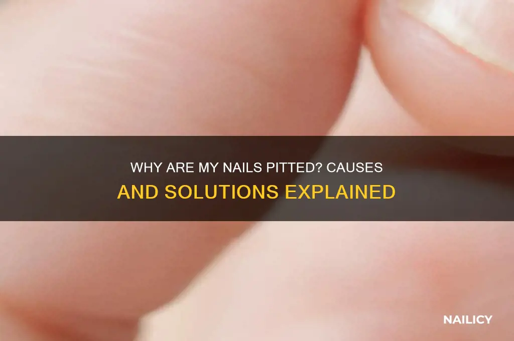 why are my nails pitted