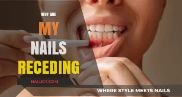 Why Are My Nails Receding? Causes, Concerns, and Solutions Explained