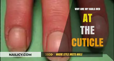 Red Cuticles Explained: Causes and Solutions for Nail Discoloration