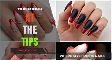 Red Nail Tips: Causes and Concerns Explained