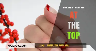 Red Nail Tips: Causes and Concerns for Your Fingertips