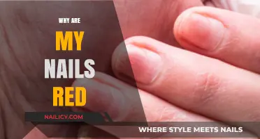Why Are My Nails Red? Causes, Concerns, and Solutions Explained