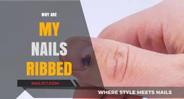 Why Are My Nails Ribbed? Causes and Solutions Explained