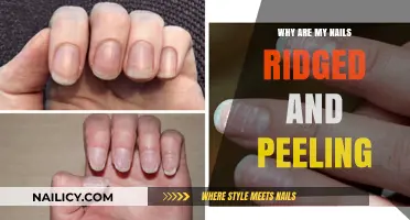 Ridged and Peeling Nails: Causes, Solutions, and Healthy Nail Care Tips
