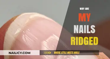 Why Are My Nails Ridged? Causes and Solutions Explained