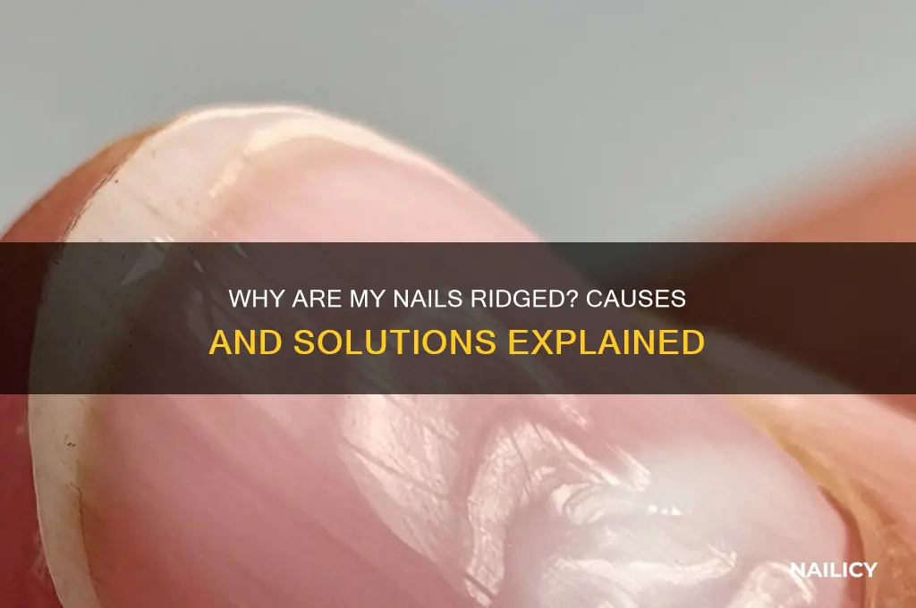 why are my nails ridged