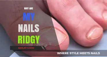 Why Are My Nails Ridgy? Causes and Solutions Explained