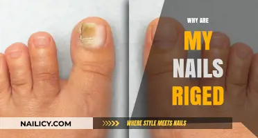 Why Are My Nails Ridged? Causes and Solutions Explained