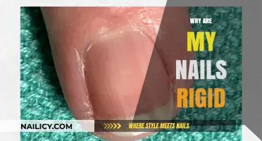Why Are My Nails Rigid? Causes and Solutions Explained