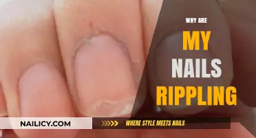 Rippling Nails: Causes, Concerns, and Solutions for Healthy Nail Care