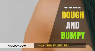 Why Are My Nails Rough and Bumpy? Causes and Solutions