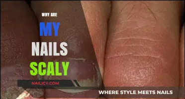 Scaly Nails Explained: Causes, Treatments, and Prevention Tips