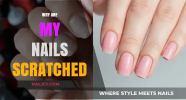 Why Are My Nails Scratched? Causes and Solutions for Damaged Nails
