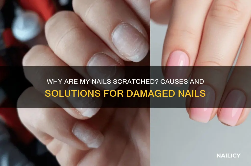 why are my nails scratched