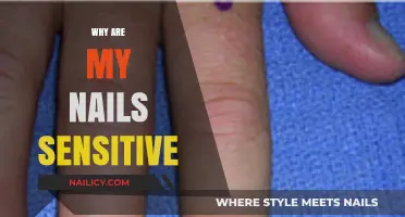 Why Are My Nails Sensitive? Causes, Remedies, and Prevention Tips