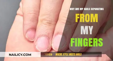 Nail Separation Explained: Causes and Solutions for Detaching Fingernails
