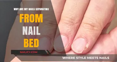 Nail Separation Explained: Causes and Solutions for Lifted Nails