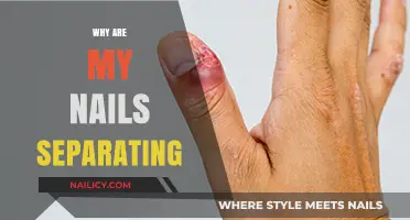 Why Are My Nails Separating? Causes, Prevention, and Treatment Tips