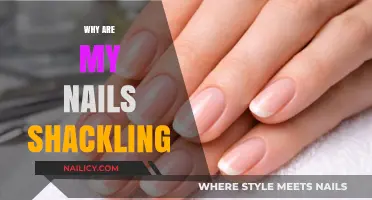 Why Are My Nails Splitting? Causes and Solutions for Brittle Nails
