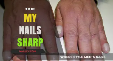 Sharp Nails Explained: Causes, Prevention, and Gentle Solutions for Comfort