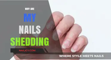 Why Are My Nails Shedding? Causes and Solutions Explained