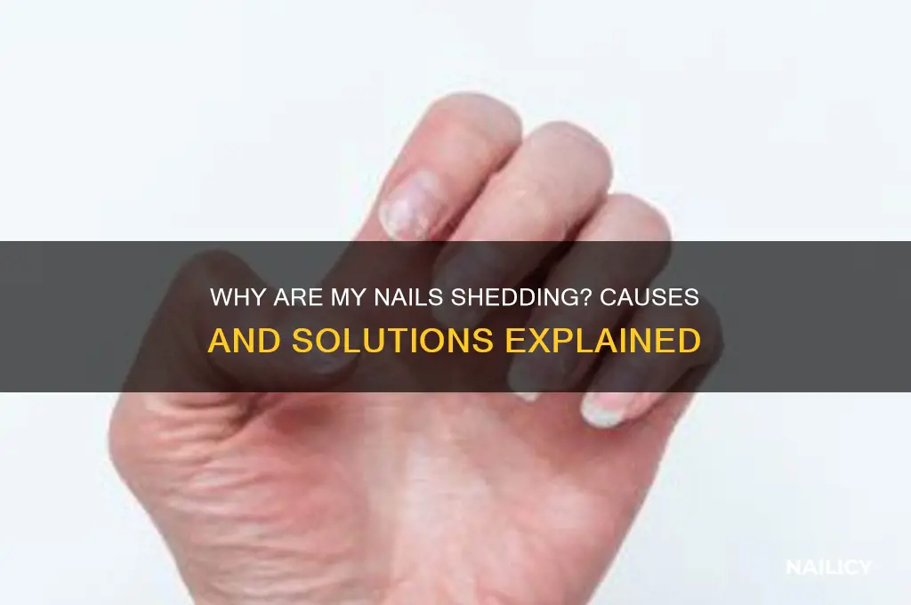 why are my nails shedding