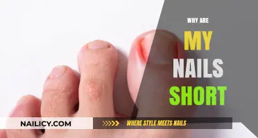 Why Are My Nails Short? Causes and Solutions for Stubborn Stumps