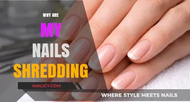 Why Are My Nails Shredding? Causes and Solutions for Brittle Nails